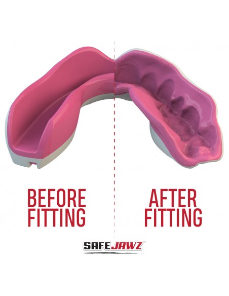 Acquista il paradenti Safejawz Extro Series "Fangz Pink" online