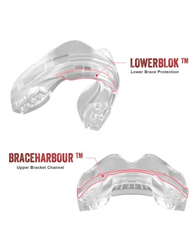 Safejawz Ortho Series Mundschutz für Zahnspangen